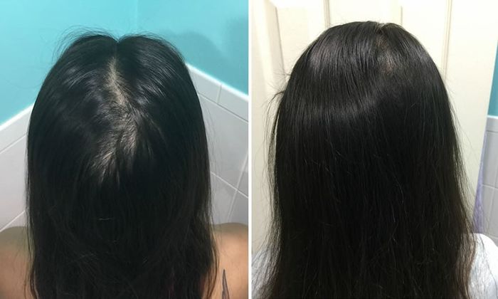 Featured image of post Cara Menumbuhkan Rambut Dengan Cepat Secara Alami Simak cara memanjangkan rambut secara alami di sini