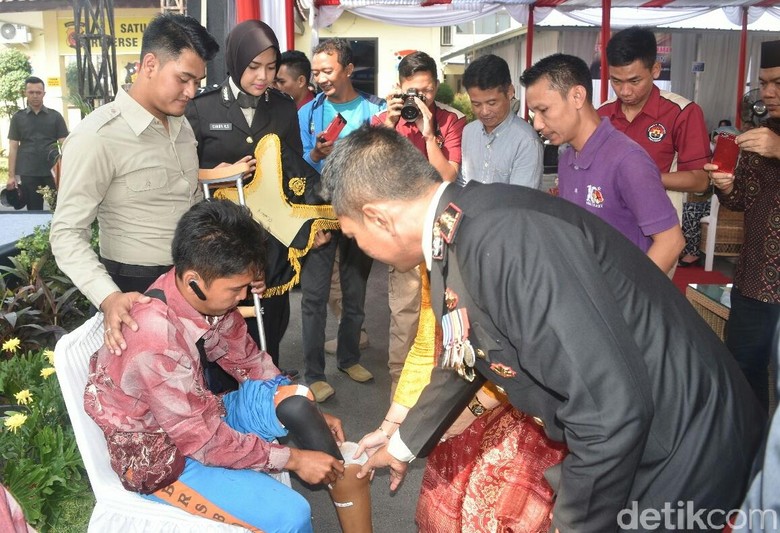 HUT Bhayangkara, Warga Cirebon Bahagia Terima Kado Kaki Palsu HUT Bhayangkara, Warga Cirebon Bahagia Terima Kado Kaki Palsu