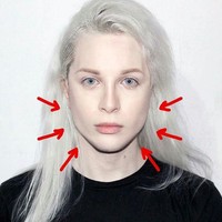 Untuk tampilan ala peri, Luis sudah operasi hidung dan liposuction rahang yang dilakukan di waktu bersamaan. Foto: Instagram @luispadron.elf