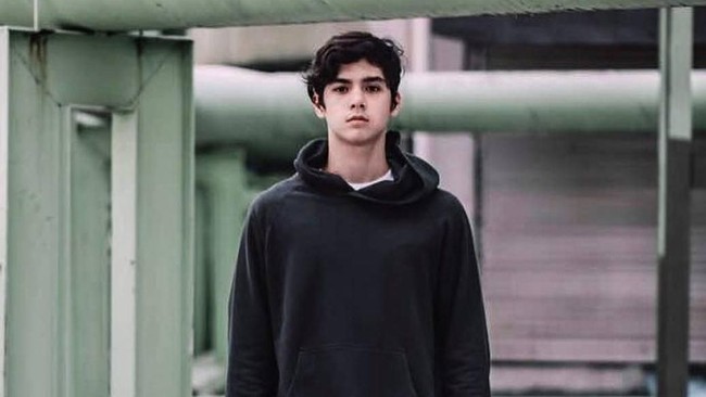 4 Fakta Stevens Johnson Syndrome yang Dikait-kaitkan dengan Al Ghazali