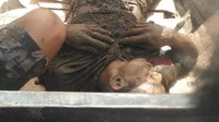 Alasannya untuk mengurangi aliran listrik yang ada di dalam tubuh Susanto.   