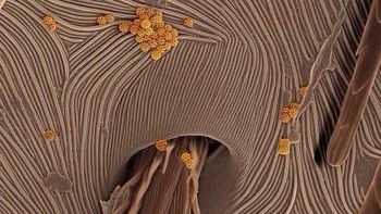 Kulit laba-laba. Foto: instagram.com/pod.mikroskopom