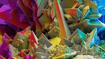 Batu ginjal. Foto: instagram.com/pod.mikroskopom