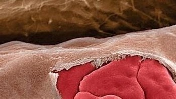 Pendarahan arteri. Foto: instagram.com/pod.mikroskopom