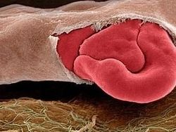 Bikin Terperangah! Ketika Benda-benda Dilihat dari Mikroskop