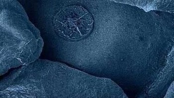 Blueberry. Foto: instagram.com/pod.mikroskopom