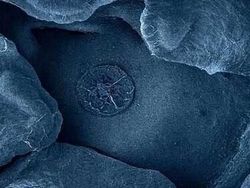 Bikin Terperangah! Ketika Benda-benda Dilihat dari Mikroskop