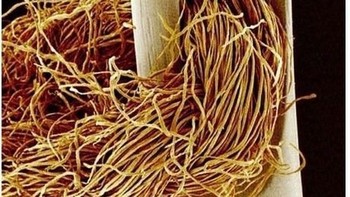 Lubang jarum. Foto: instagram.com/pod.mikroskopom