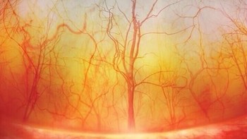 Mata manusia. Foto: instagram.com/pod.mikroskopom