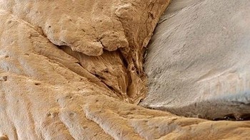 Bagian kulit dan kuku manusia.  Foto: instagram.com/pod.mikroskopom