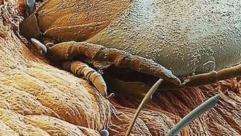 Tungau. Foto: instagram.com/pod.mikroskopom