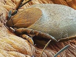 Bikin Terperangah! Ketika Benda-benda Dilihat dari Mikroskop