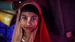 Foto: Gadis Rohingya yang Kuning Wajahnya