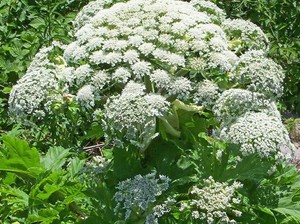 Ngeri! Wajah ABG Ini Mendadak Terbakar Usai Bersentuhan Hogweed