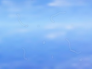Sering Melihat Bintik Putih Mengambang di Mata? Ini Alasannya