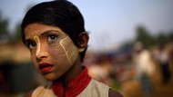 Foto: Gadis Rohingya yang Kuning Wajahnya