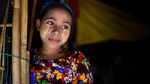 Foto: Gadis Rohingya yang Kuning Wajahnya