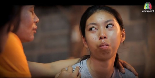 Di universitas, orang-orang melihat saya dan tertawa. Saya merasa seperti monster, kata Jitraporn. Foto: Instagram