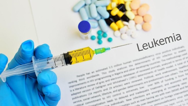 Waspadai Faktor Risiko Leukemia, Seperti Diidap Dian Pramana Poetra