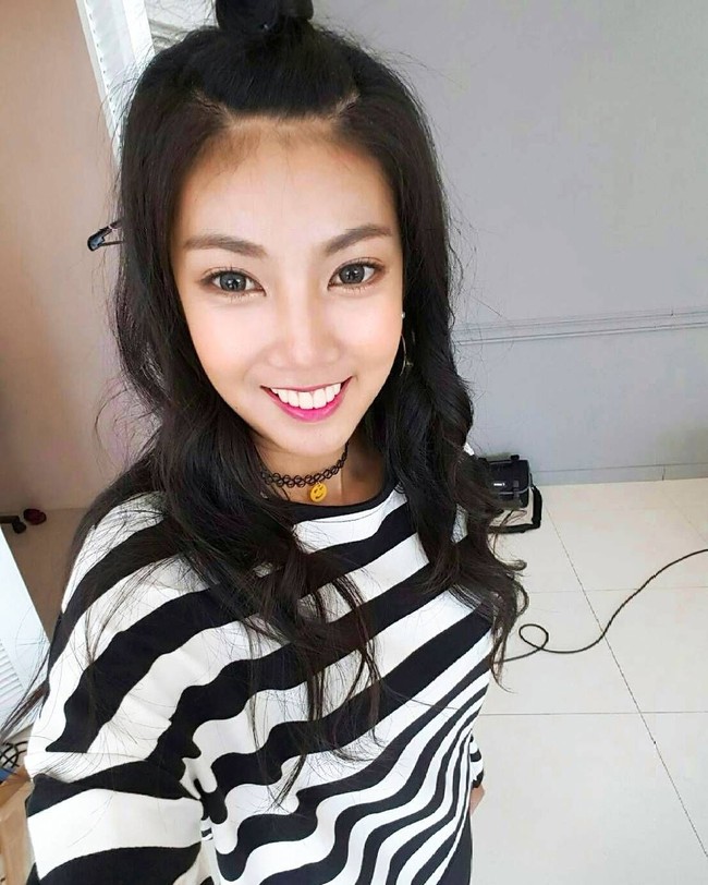 Ia dikirim ke Korea Selatan untuk menjalani serangkaian operasi lengkap. Wanita berambut panjang ini menjalani operasi untuk memperbaiki rahangnya yang bengkok dan susunan tampilan giginya. Foto: Instagram