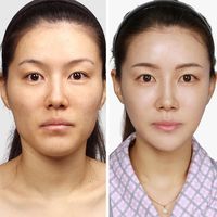 Foto: Agenda Kesehatan