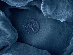 Potret Mencengangkan Benda-benda di Bawah Mikroskop