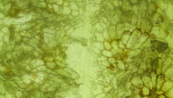 Buah nanas. (Foto: Brightside)