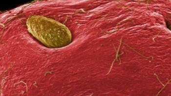 Strawberry. (Foto: Brightside)