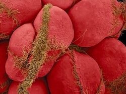 Potret Mencengangkan Benda-benda di Bawah Mikroskop