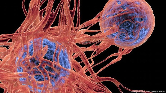 Peneliti Australia Kembangkan Tes Darah Pertama di Dunia Yang Bisa Deteksi Kanker Kulit Melanoma