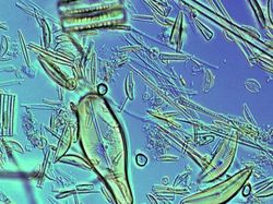 Potret Mencengangkan Benda-benda di Bawah Mikroskop