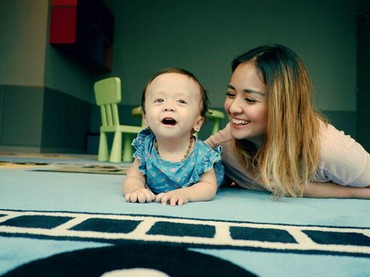 Semangat Putri Bungsu Joanna Alexandra Hadapi Penyakit Langka