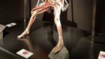 Museum Jenazah Surganya Para Pecinta Anatomi, Jangan Lihat Kalau Takut!