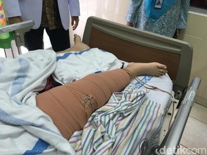 Kanker Tulang: Penyebab, Gejala, Jenis, dan Cara Pengobatannya