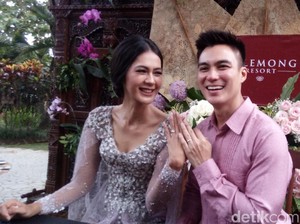 Sebentar Lagi Nikah, Baim Wong Sudah Mulai Perawatan