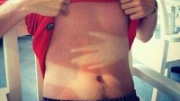 Nah, buat kamu yang suka berjemur di bawah terik matahari, jangan sampai badan kamu seperti foto ini. Foto: Internet
