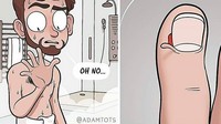 Kamu pasti pernah mengalami kulit samping kuku terkelupas kan? Foto: Instagram/adamtots