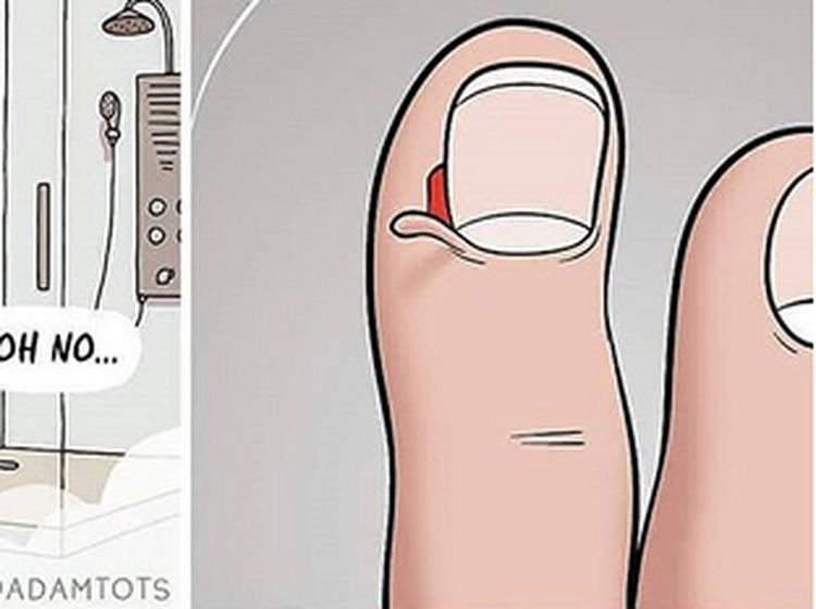 Foto: Ilustrasi Kulit Samping Kuku Terkelupas yang Bikin Ngilu
