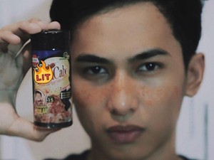 Pria Ini Ikuti Tren Makeup Freckles Pakai Bubuk Cabai, Ngenes Tapi Kocak