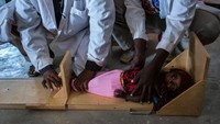 Seorang anak di Somalia diukur tingginya untuk tanda-tanda stunting akibat malnutrisi kronis. (Foto: Getty Images) 