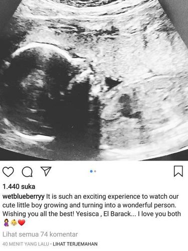 Manis Banget! El Barack Ultah, Ludwig: I Love You Both