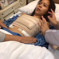 Pada akhir Desember lalu, May menjalani operasi pembesaran payudara, dan membayar THB800 ribu atau Rp Rp 326 juta. Namun, operasi tersebut membuat dirinya koma, dimana ia hanya memiliki 10 persen peluang untuk bertahan hidup. Beruntungnya ia pun berhasil lolos dari maut. Foto: Instagram