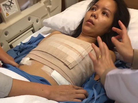 Artis Cantik Ini Hampir Tewas Usai Jalani Operasi Pembesaran Payudara