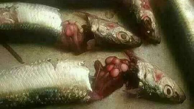 Bulatan-bulatan mirip telur yang disebut tumor dalam pesan berantai, ternyata adalah parasit Glugea sardinellensis.