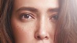 Hiks! Penampilan Makeup Freckles Shandy Aulia Malah Kena Bully Netizen