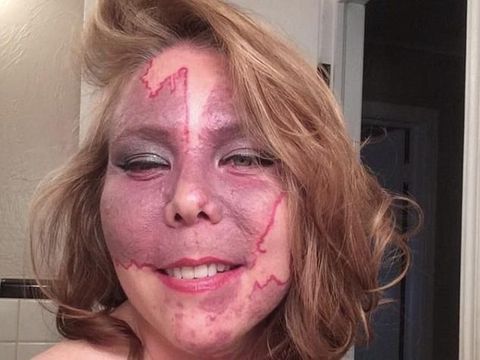 Anne Antonelli sempat tak percaya diri dan kehilangan beberapa pekerjaan karena tanda lahir di wajahnya