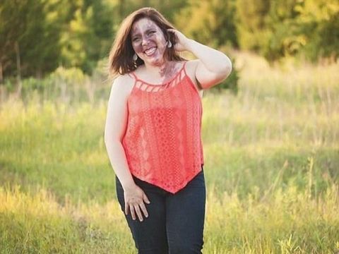 Anne Antonelli sempat tak percaya diri dan kehilangan beberapa pekerjaan karena tanda lahir di wajahnya