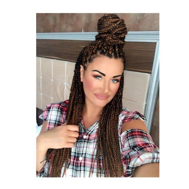 Sejak usia 25, Aime memang sudah berkenalan dengan tindakan estetika dengan melakukan Botox. Menurutnya, bermain dengan boneka Barbie dan menonton Baywatch ketika kecil menginspirasinya untuk ingin tampil sempurna. Foto: Instagram @aimis_world