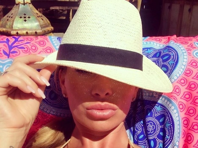 Natalie juga secara berkala melakukan botox dan filler. Ini salah satu hasil filler bibirnya. Bibir Natalie yang aslinya tipis menjadi lebih bervolume dengan rutin filler.  Foto: dok. Instagram (@natalierichmarbella)