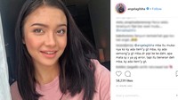 mba itu muka-nya ko ky ada itemy gt mba.. ky ada cemongy gt mba..dr pipi ke ke dahi. apa mata sy x ya yg error. tapi itu beneran deh mba, ky ada itemy gt. komentar netizen kala itu. Foto: Dok. Instagram (Angela Gilsha)